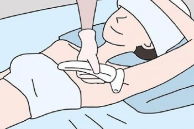 使用家用光子脱毛仪，你需要知道这几点