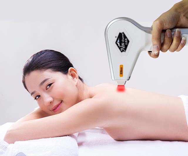 家用光子脱毛仪种草指南(图2)