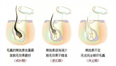 为什么小姐姐们都选择在春季脱毛呢？