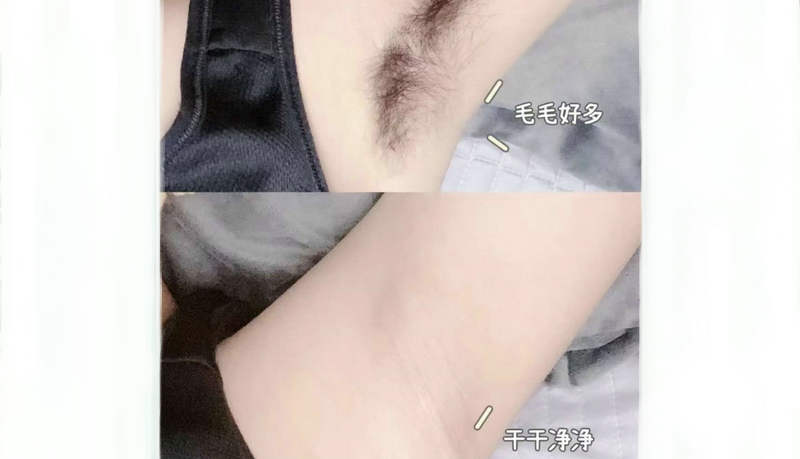 秋天脱毛有什么好处吗？(图1)